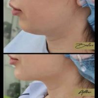 Client transformation result 01