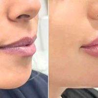 Client transformation result 03