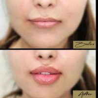 Client transformation result 04