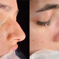 Client transformation result 05